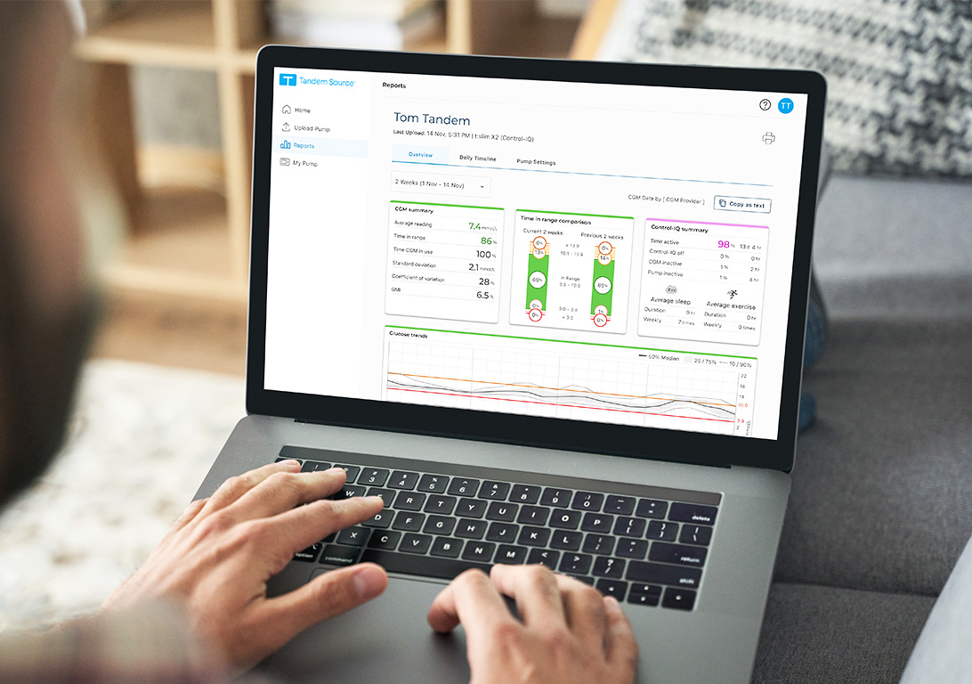 Tandem Source Reports