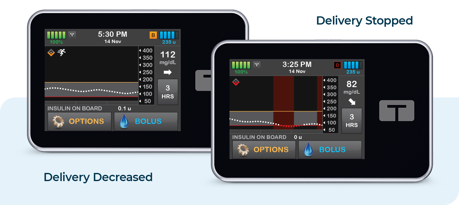 Control-IQ Technology decreasing and stopping insulin delivery