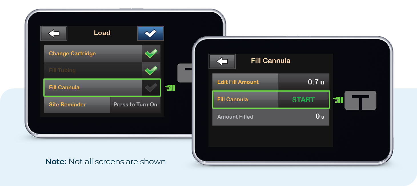 Load and Fill Cannula Screens. Note: Not all screens are shown.