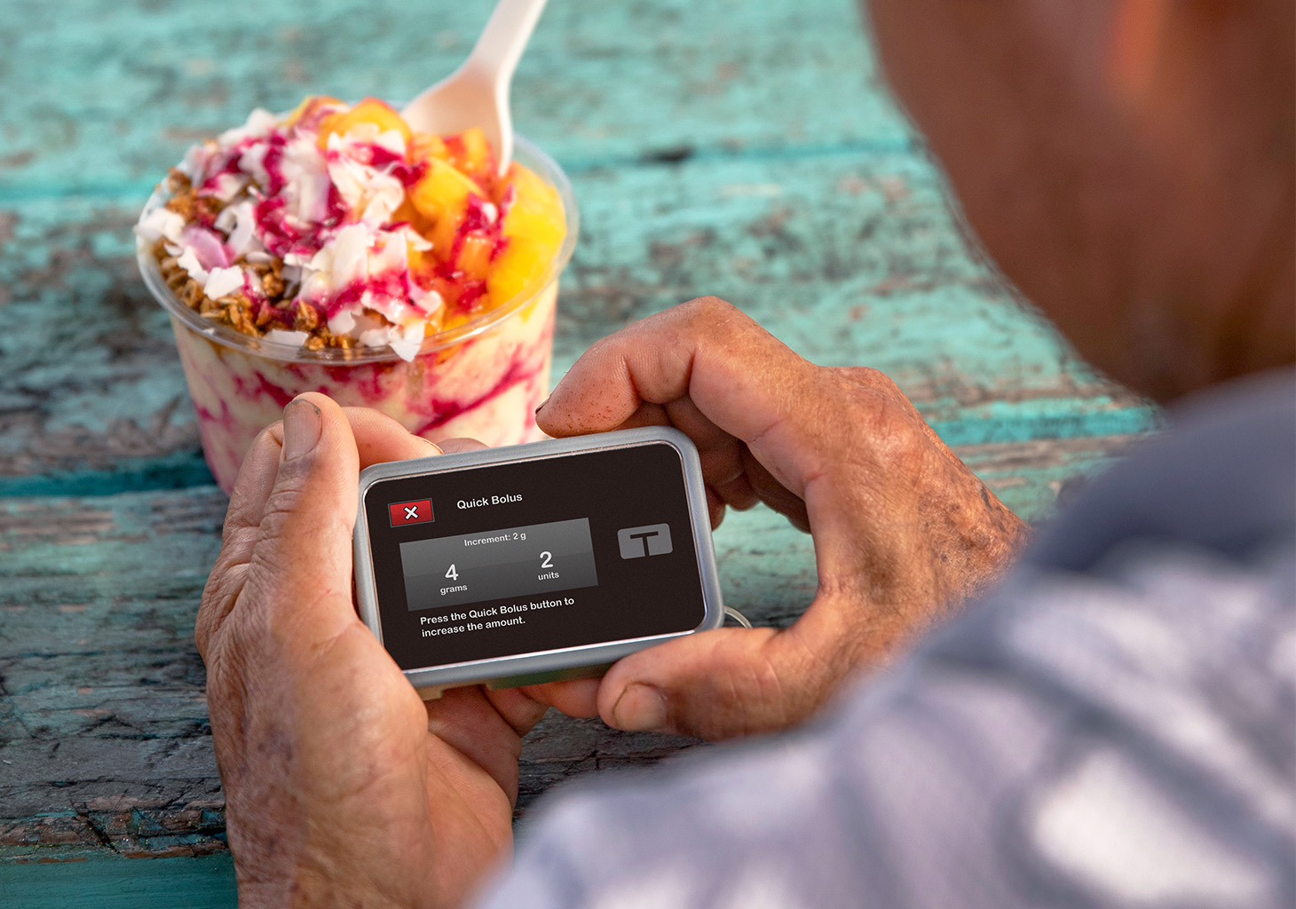 Man Using Quick Bolus Button to Deliver Bolus