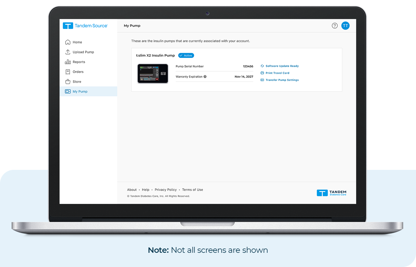 Update Available in the My Pump Section of Tandem Source. Note: Not all screens are shown.