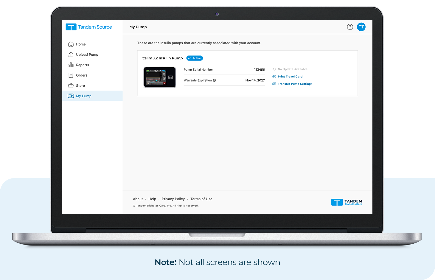 No Updates Available in the My Pump Section of Tandem Source. Note: Not all screens are shown.