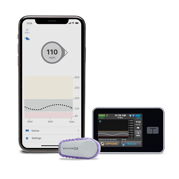 insulin pump dexcom g6