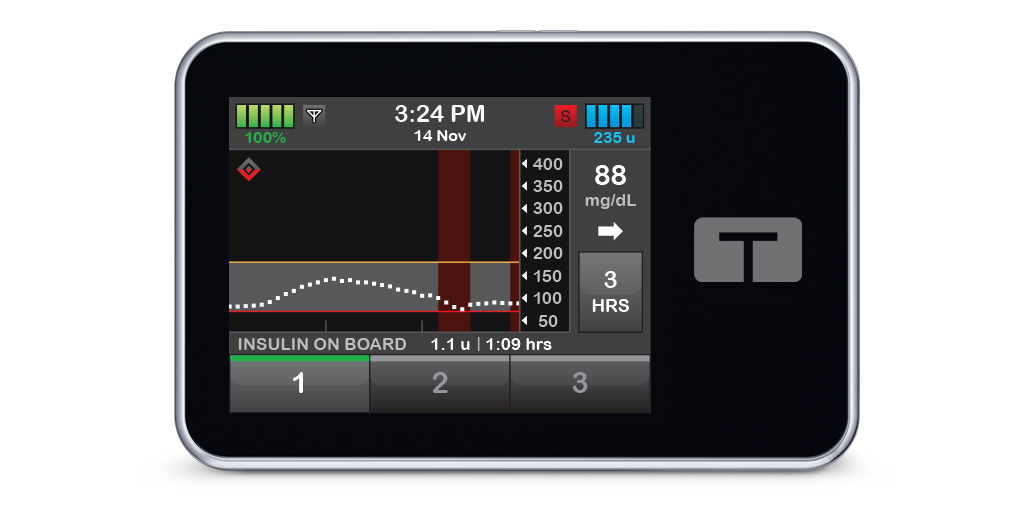 dexcom g6 cgm unavailable