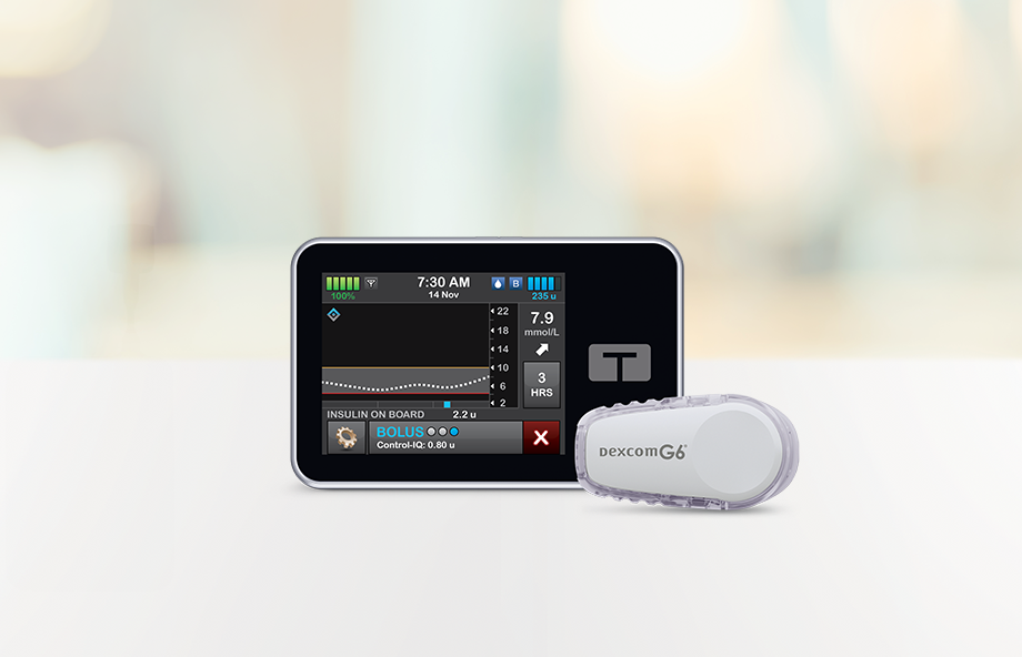 The Tandem t:slim X2 and Dexcom G6 CGM