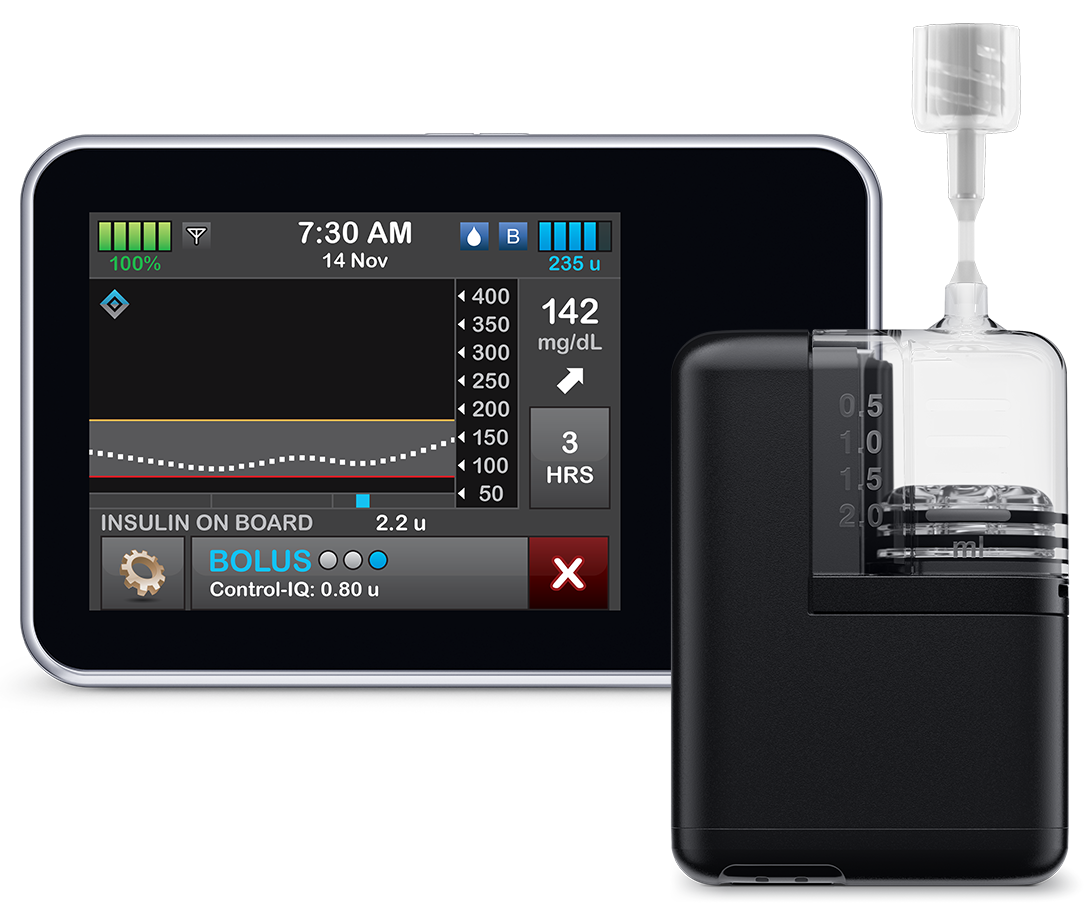 Tandem Insulin Pumps