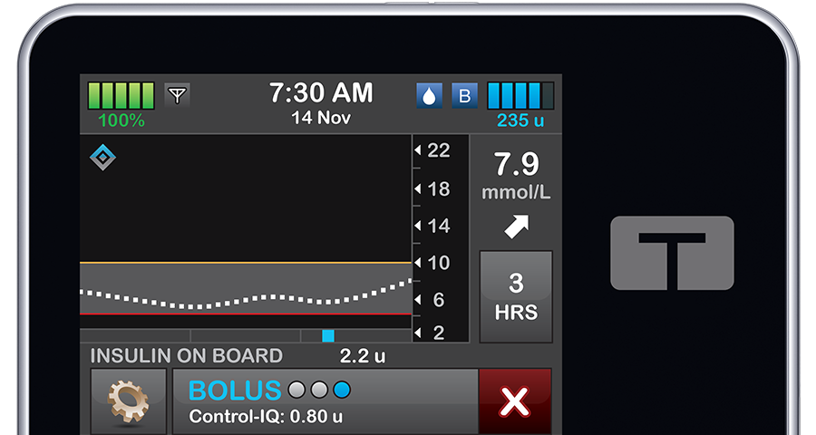 t:slim X2 Insulin Pump