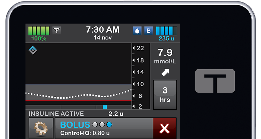 t:slim X2 Insulin Pump