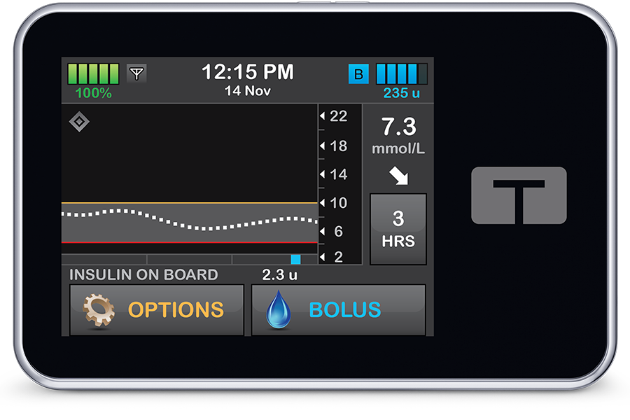 t:slim X2 insulin pump