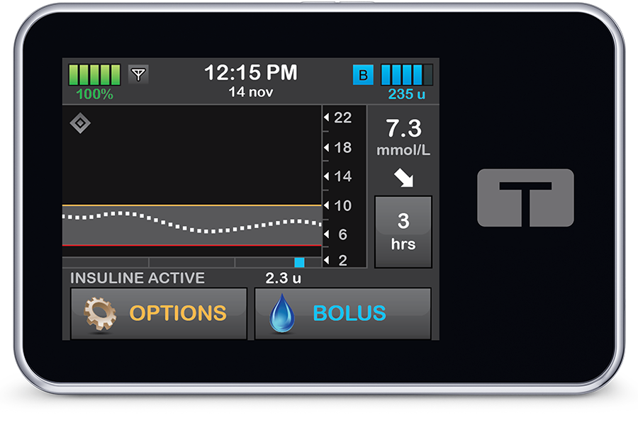 t:slim X2 insulin pump