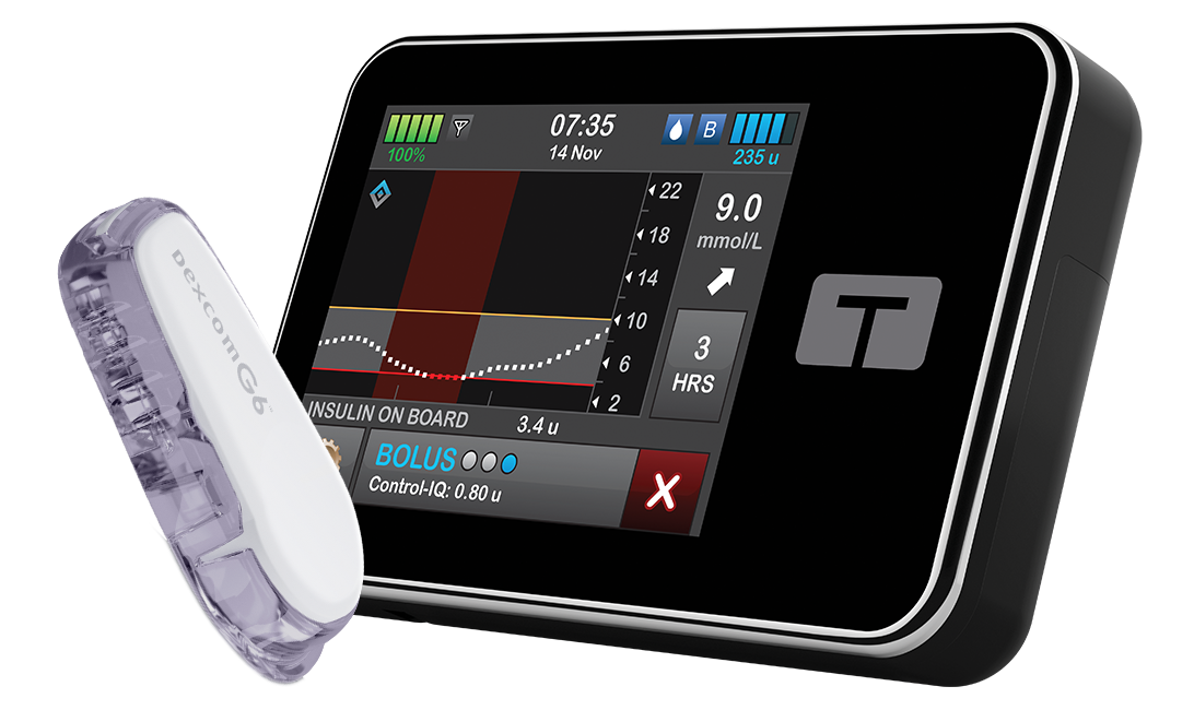 Control-IQ Software Update | Tandem Diabetes Care