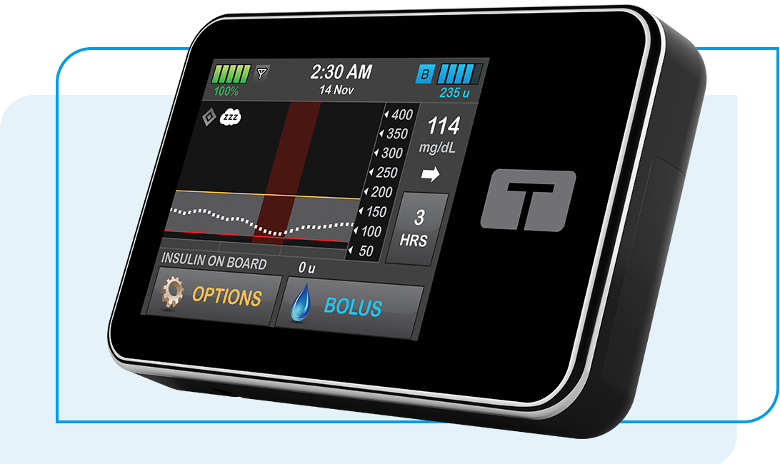 tandem and dexcom g6