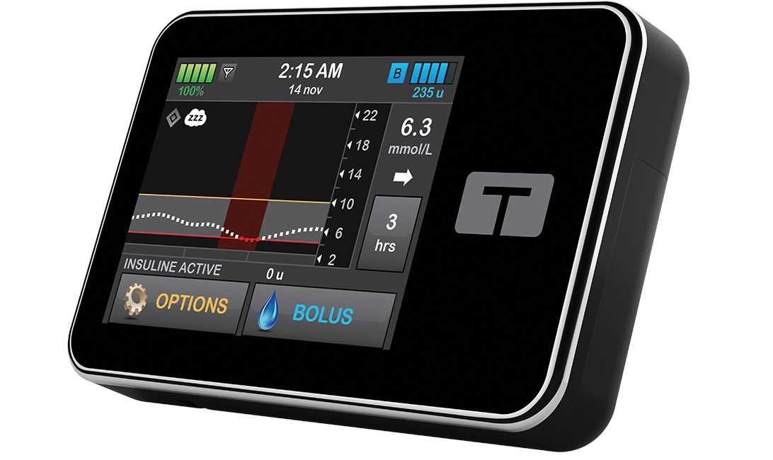 t:slim X2 Insulin Pump with Control-IQ Technology and Sleep Activity