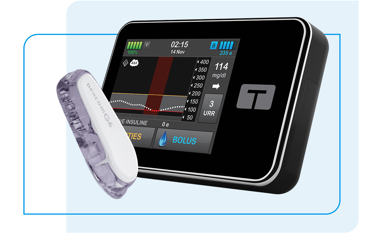 t:slim X2 insulin pump