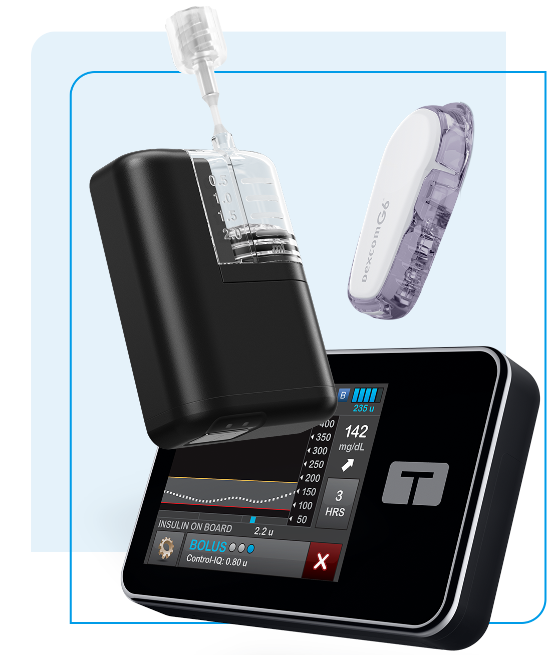 Tandem Insulin Pumps with Dexcom G6 CGM