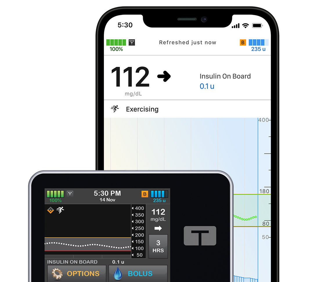 t:slim X2 insulin pump with mobile app