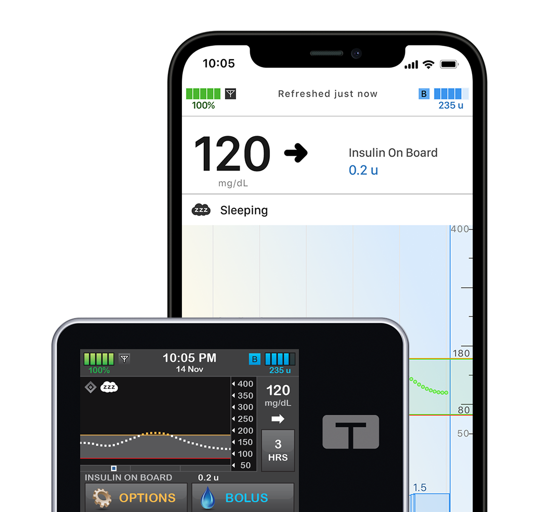 t:slim X2 Insulin Pump with Mobile App in Sleep Activity